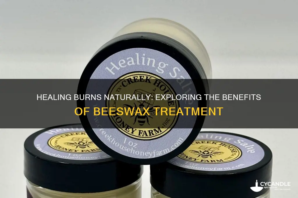is beeswax good for burns