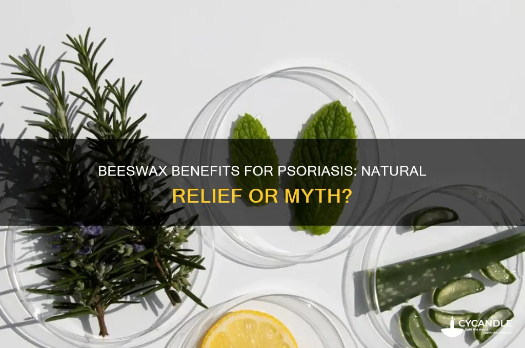 is beeswax good for psoriasis