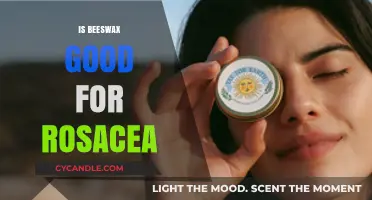 Beeswax for Rosacea: Natural Relief or Skin Irritant?