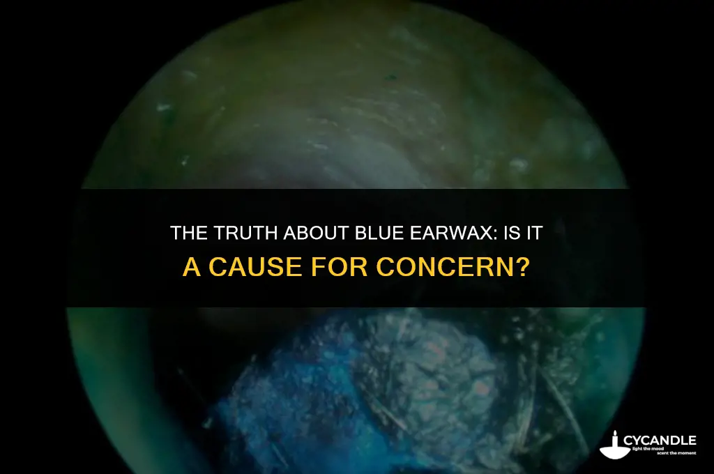 is blue ear wax dangerous