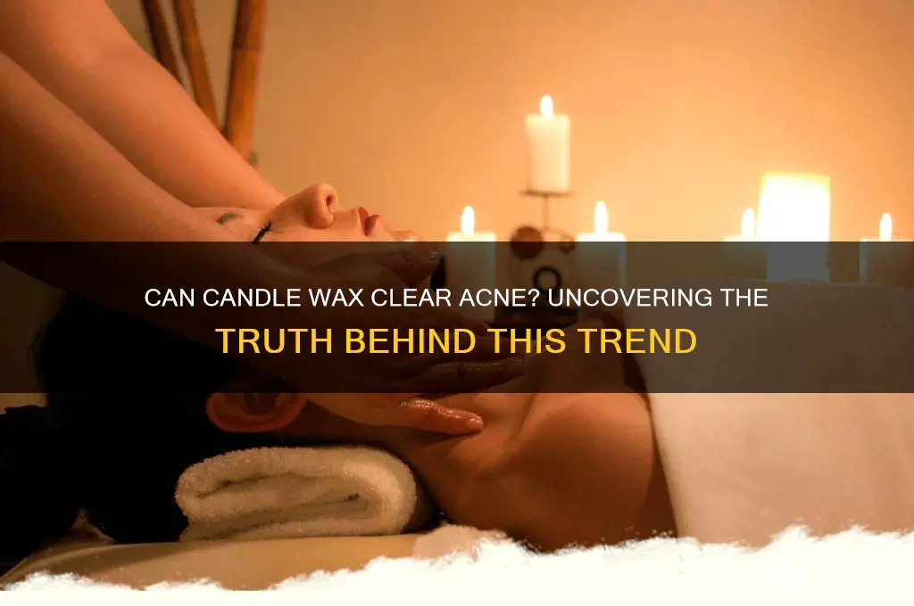 is candle wax good for acne