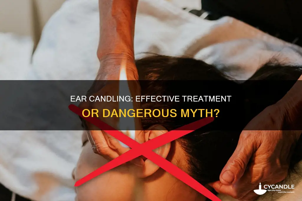 is ear candling really work