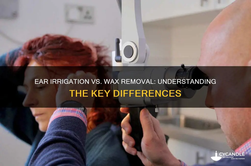 is ear irrigation same as wax removal