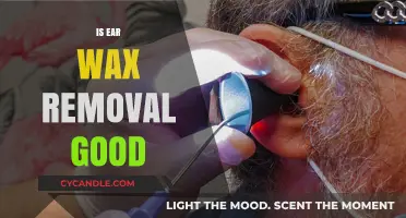 Is Ear Wax Removal Beneficial? Exploring the Pros and Cons