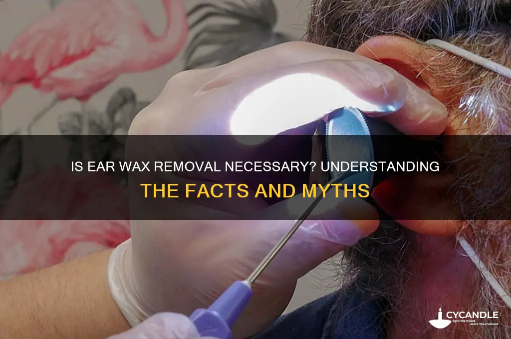 is ear wax removal necessary