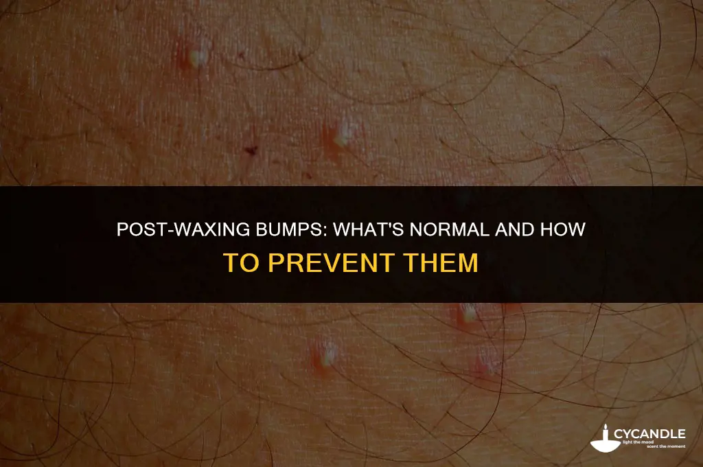 is it normal to get bumps after waxing