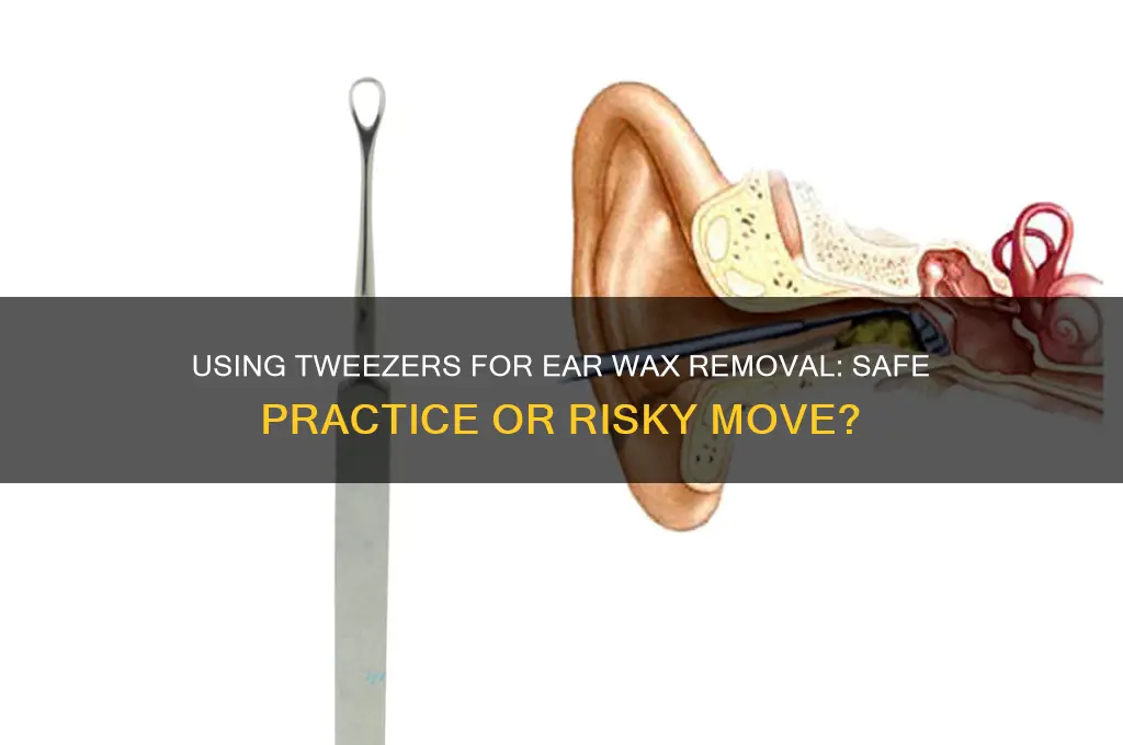 is it safe to use tweezers to remove ear wax
