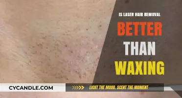 Laser Hair Removal vs. Waxing: Which Method Offers Better Results?