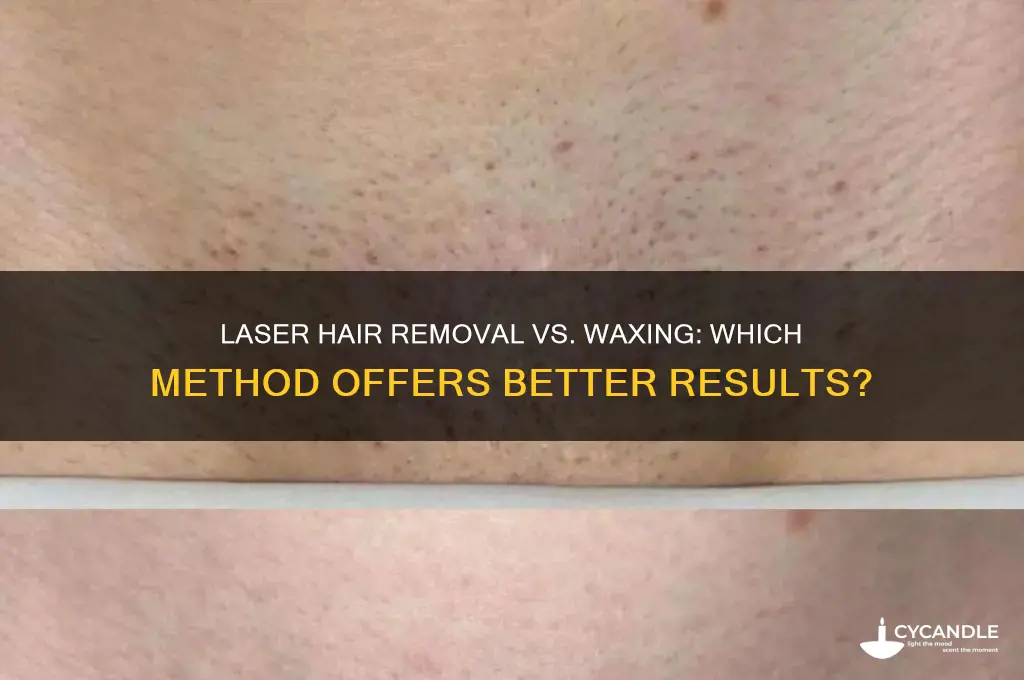 is laser hair removal better than waxing