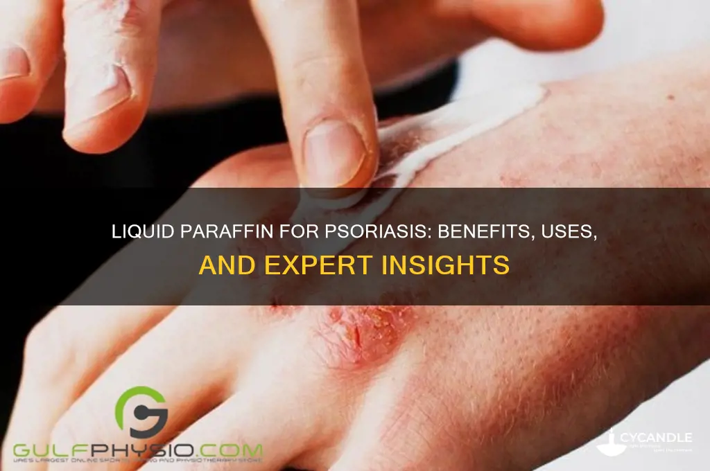 is liquid paraffin good for psoriasis