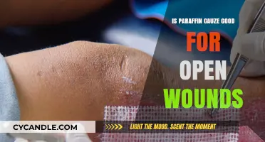 Is Paraffin Gauze Effective for Treating Open Wounds? A Review