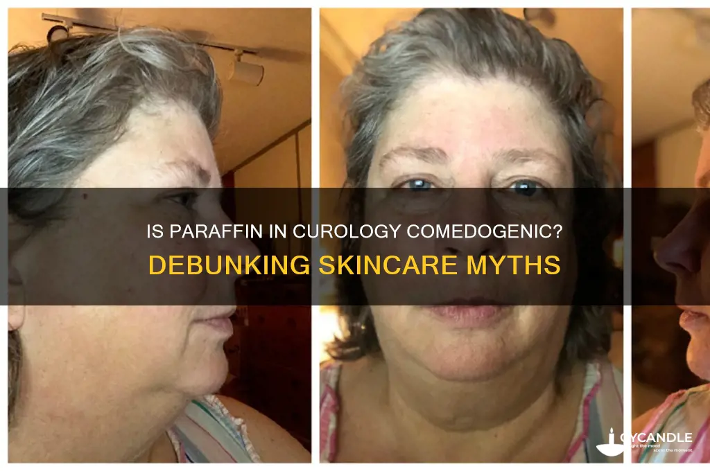is paraffin in curology comedogrnic