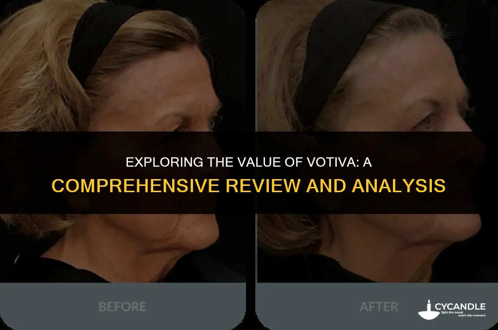 is votiva worth it
