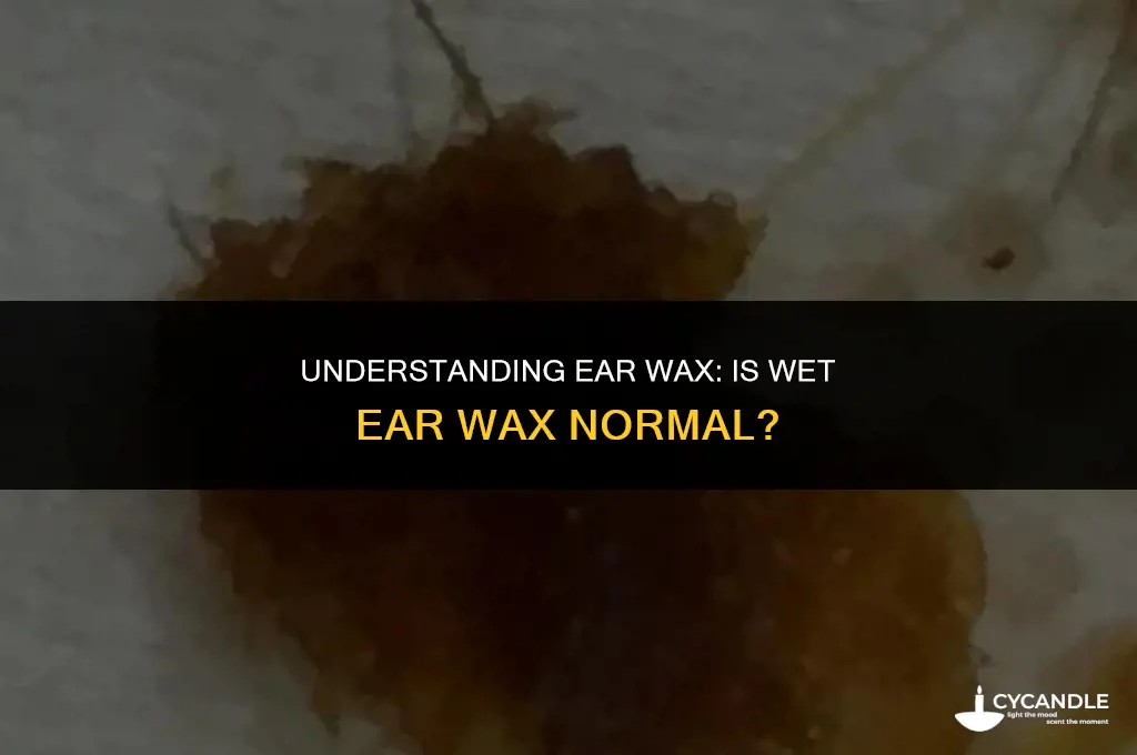 is wet ear wax normal
