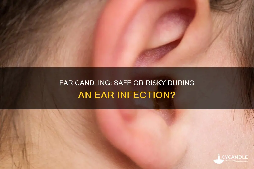 should i ear candle when i have an infection
