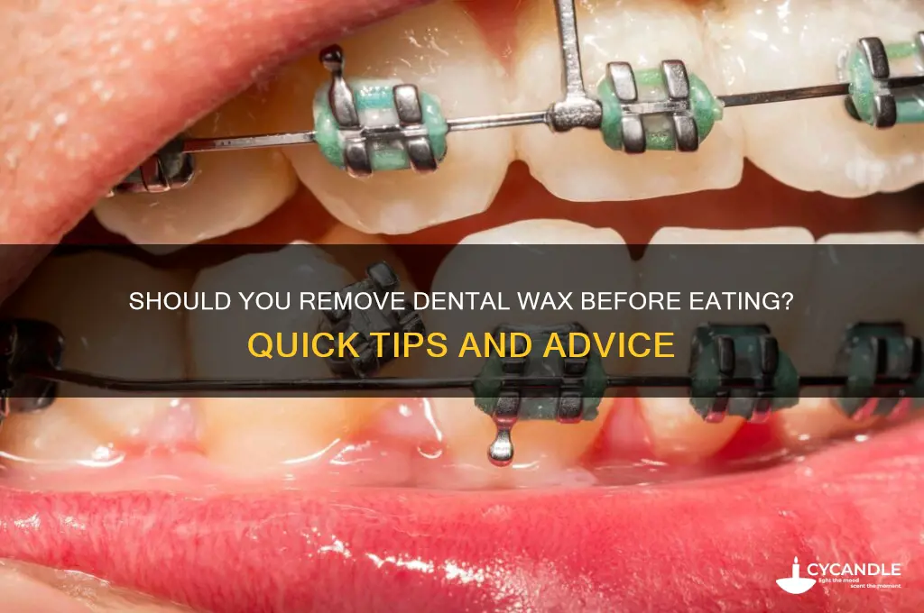 should i remove dental wax before eating