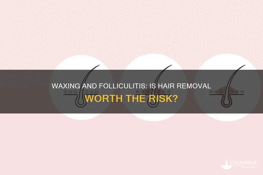 should i wax hair removal and folliculitis