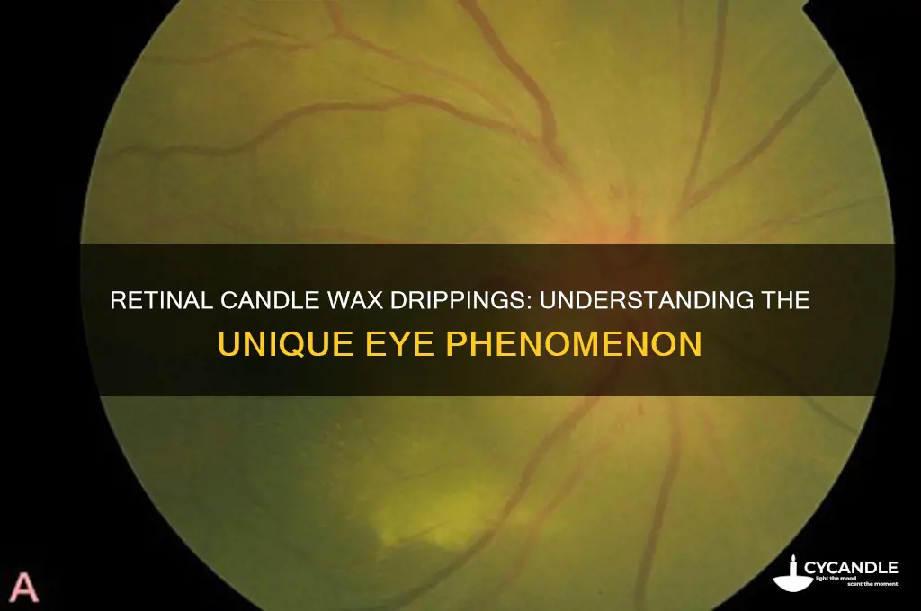 what are retinal candle wax drippings