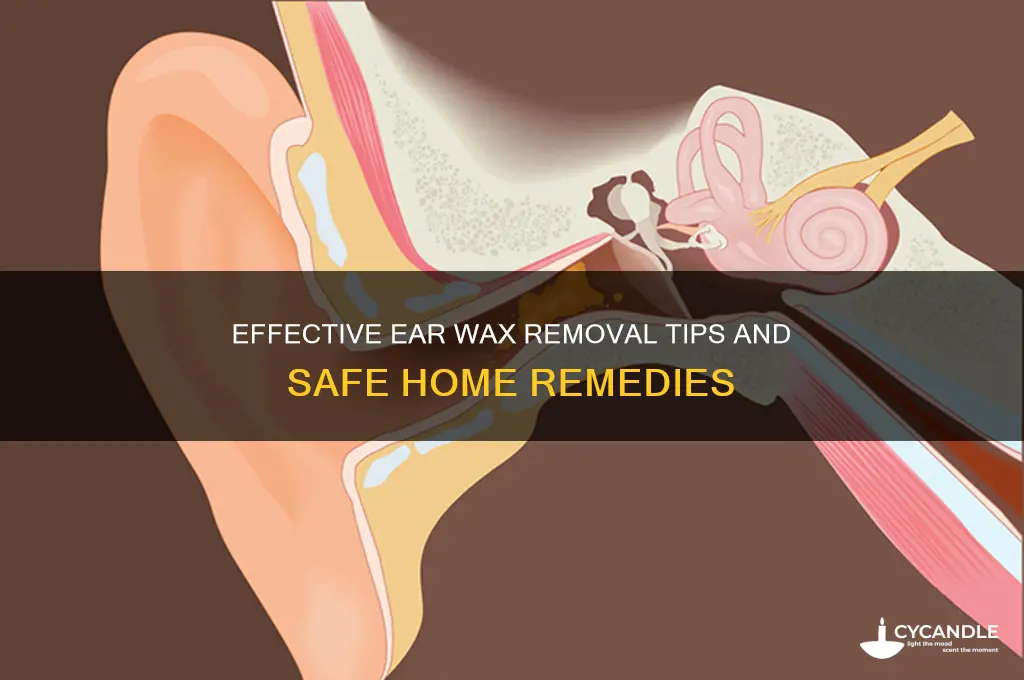 what can i do about ear wax