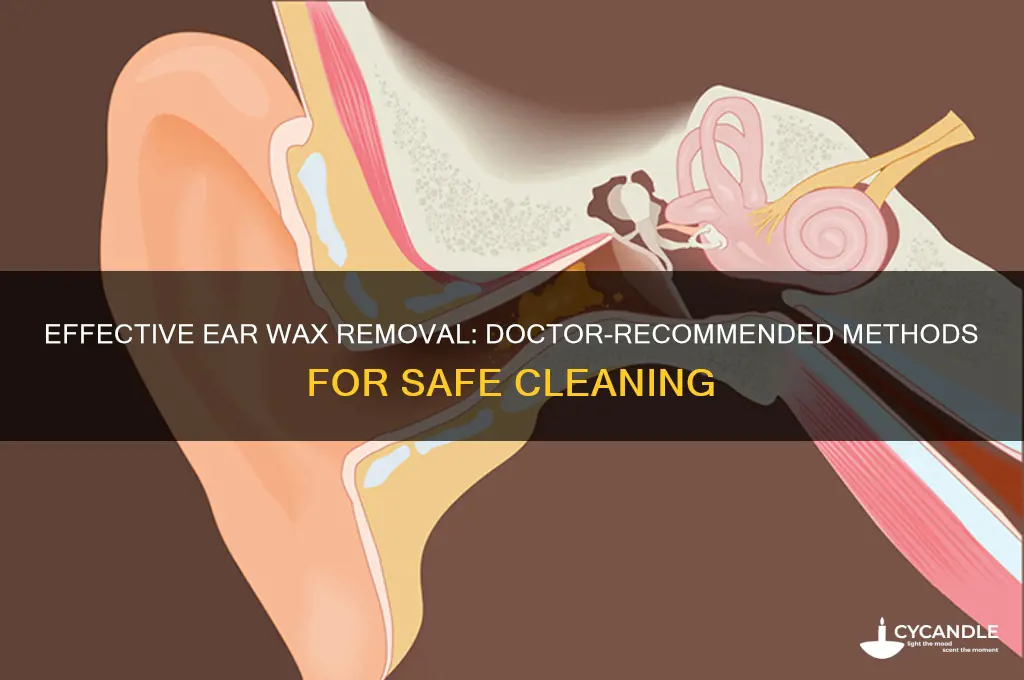 what do doctors recommend to remove ear wax