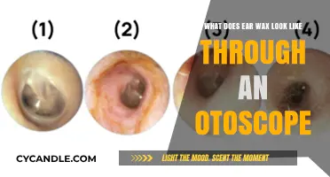 A Peek Inside: What Earwax Looks Like Through an Otoscope
