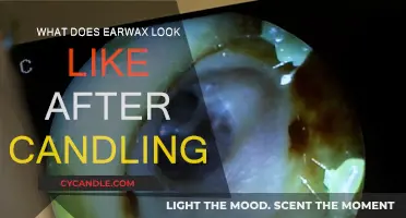 Ear Candling: What's Left Behind in Your Ears?