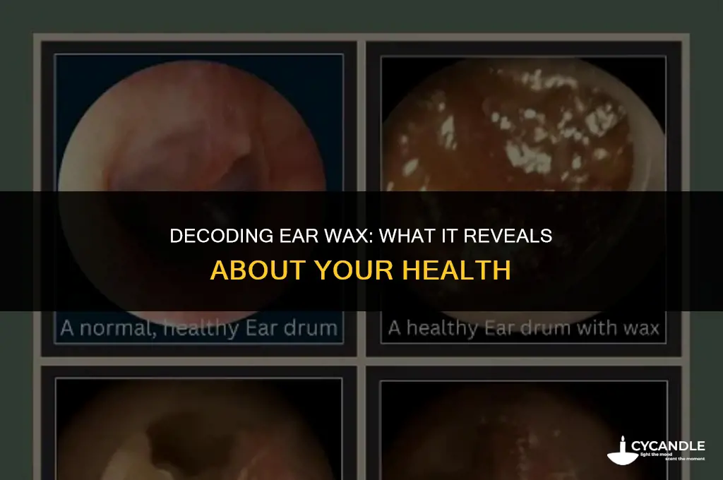 what does your ear wax say about your health