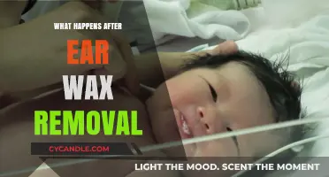 Post-Ear Wax Removal: What to Expect and How to Care