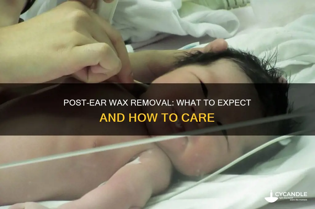 what happens after ear wax removal
