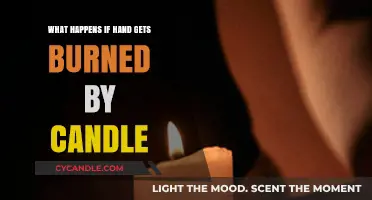 Candle Burns: Immediate Steps and Healing Process for Hand Injuries