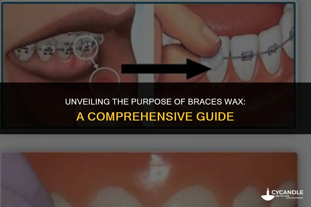 what is braces wax for