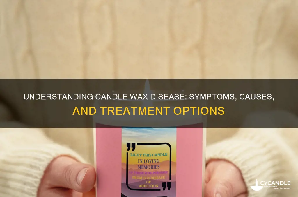 what is candle wax disease