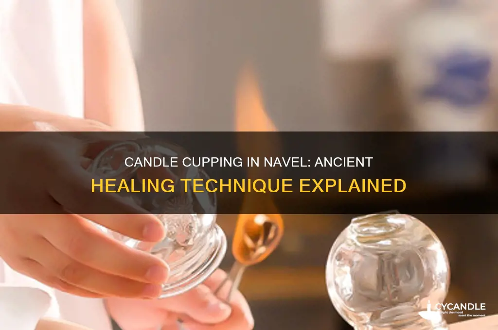 what is cupping with candle in navel