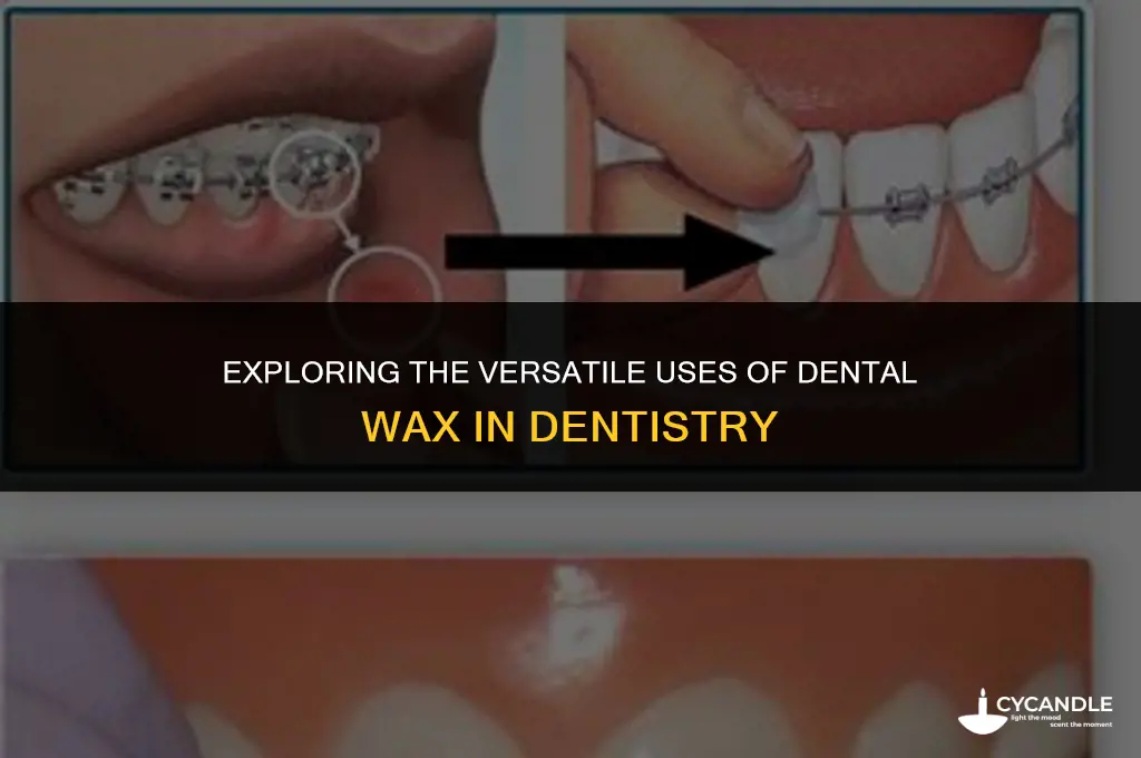 what is dental wax used for