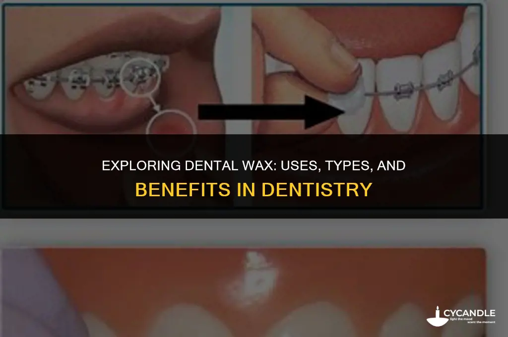 what is dental wax