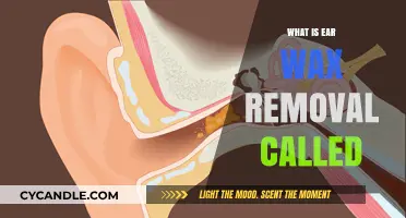 Understanding Ear Wax Removal: The Process and Its Proper Name