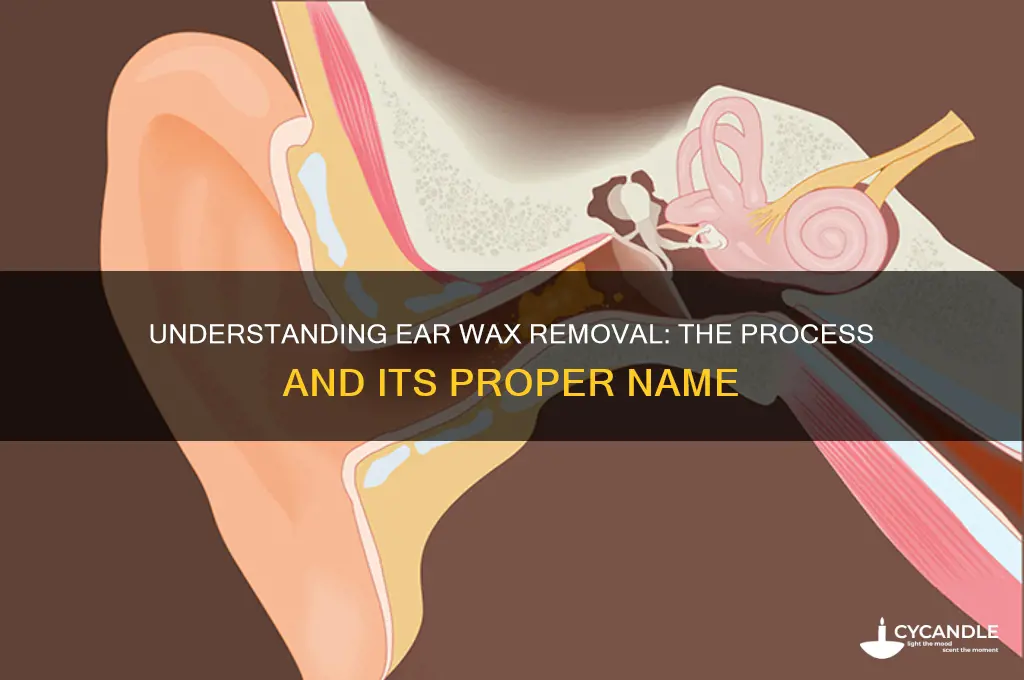 what is ear wax removal called