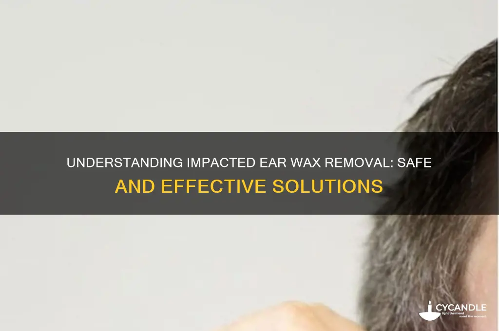 what is impacted ear wax removal