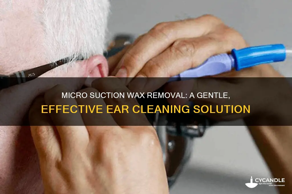 what is micro suction wax removal