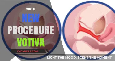 Exploring the Latest Votiva Procedure: What's New and Improved?