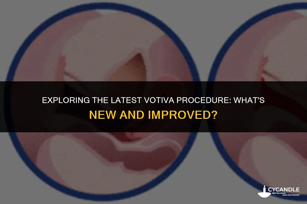 what is new procedure votiva