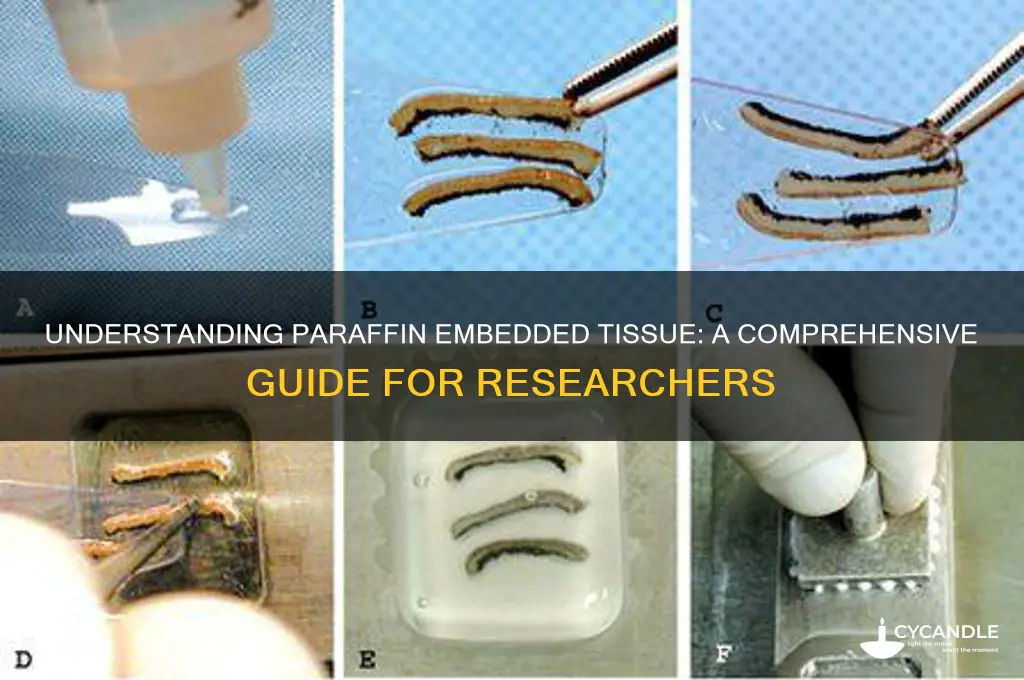 what is paraffin embedded tissue