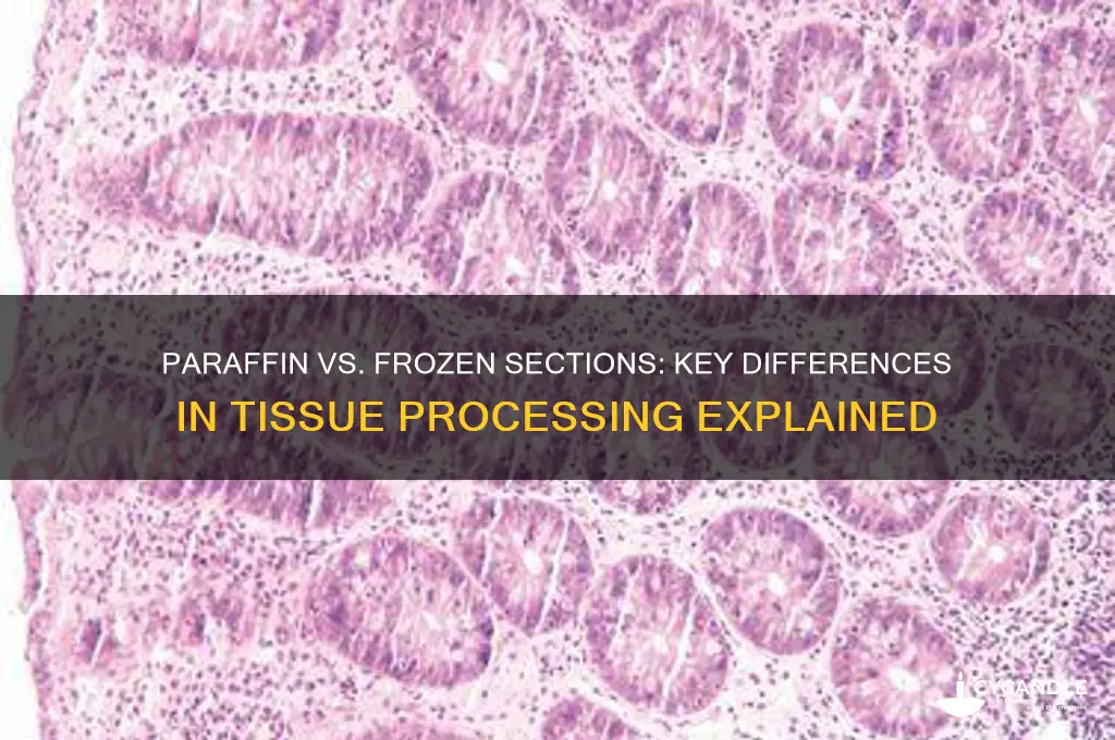 what is the difference between paraffin section and frozen section