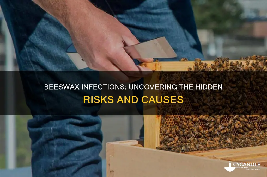 what makes beeswax give infections