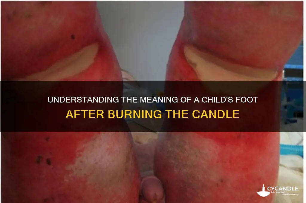 what means child foot after burn the candle