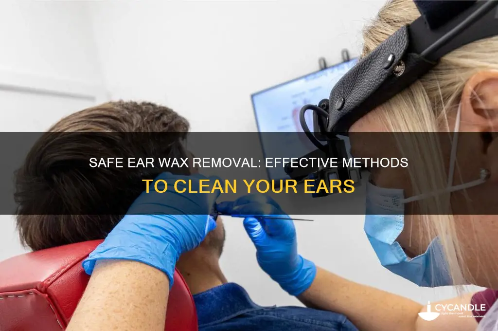 what removes ear wax safely