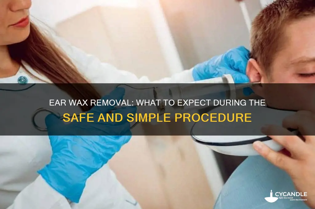 what to expect for ear wax removal
