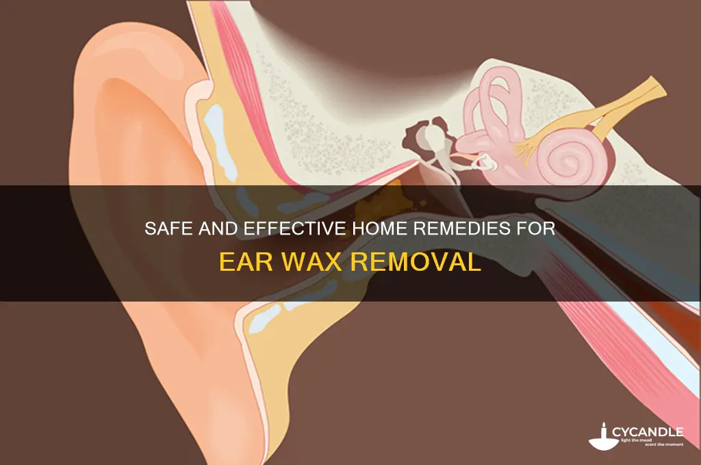 what to use to remove ear wax at home