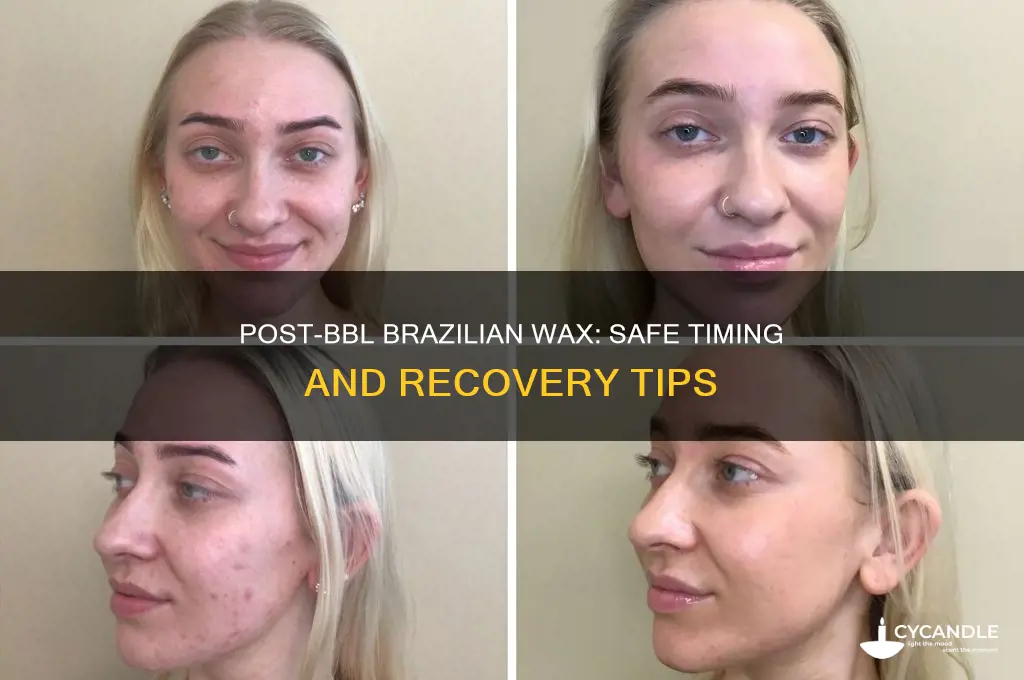 when can i get a brazilian wax after bbl