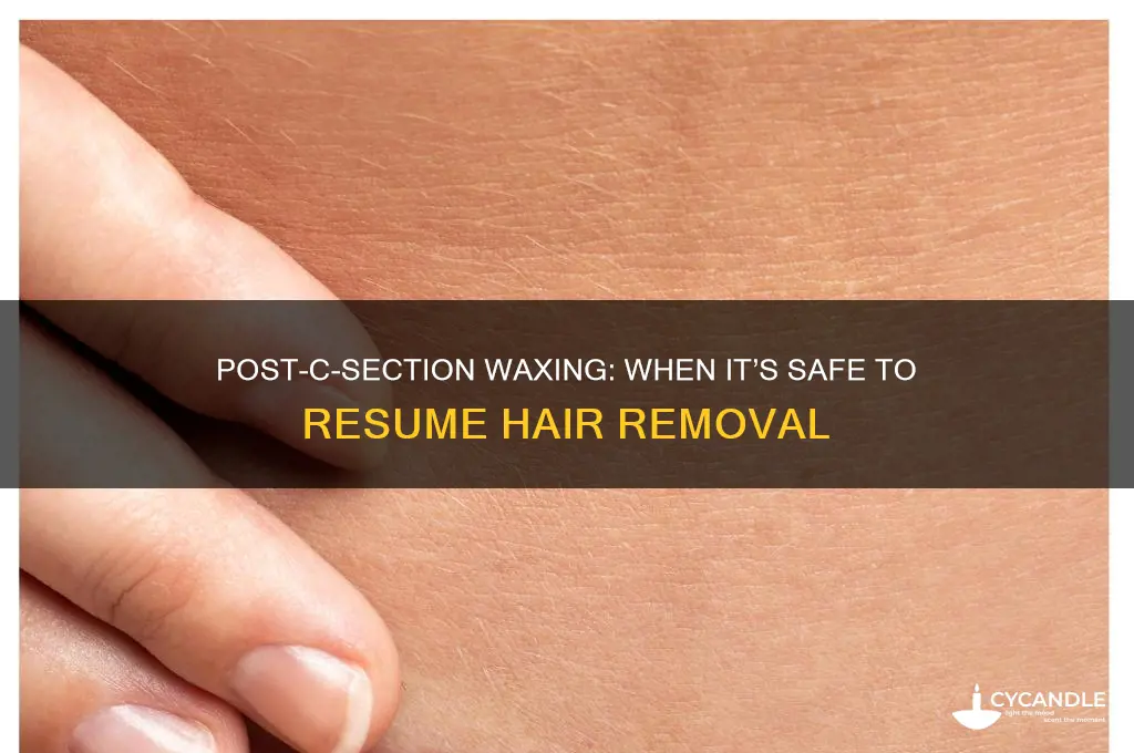 when can you get a wax after c section